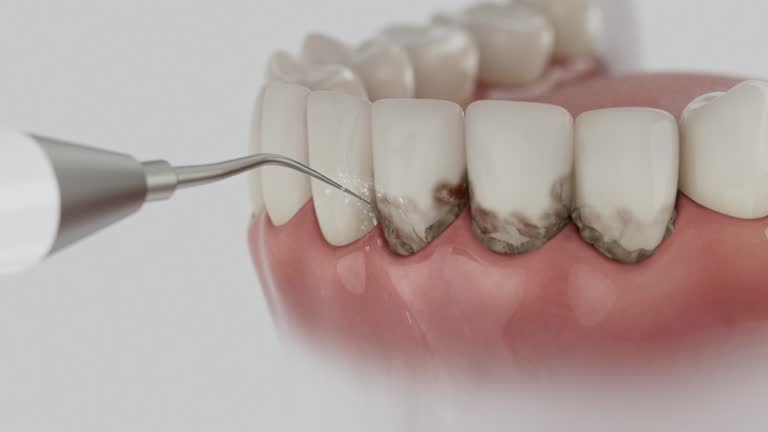 Trusted Teeth Whitening service in Jackson, LA - Dentist Open Now